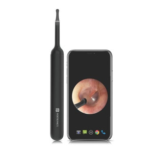 Portronics Xlife Smart Wireless Ear Otoscope Cleaner with FHD 1080 Camera